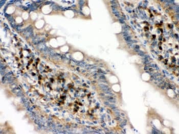 EIF4A2 Antibody