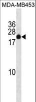 ZNF747 Antibody (aa156-182)