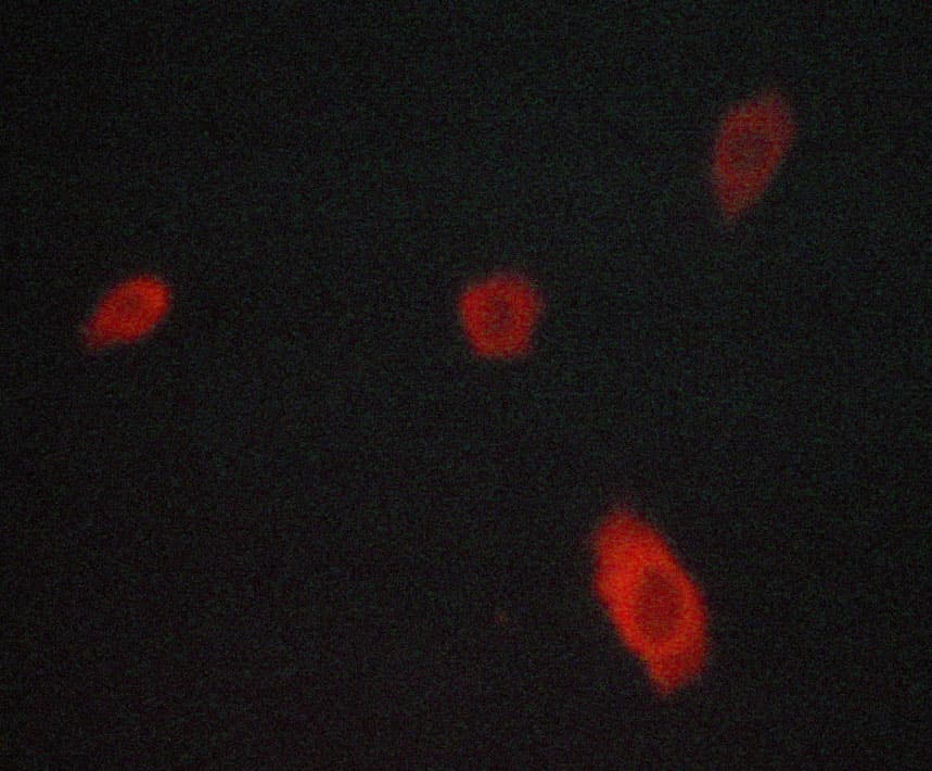 NCF1 / p47phox / p47 phox Antibody