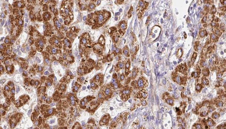 P2RX7 / P2X7 Antibody