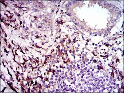 TGFB1 / TGF Beta 1 Antibody (Amino Acid: 62-195, clone 7F6)