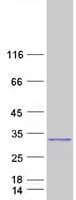 Human FGF23 Protein (Recombinant Myc-DDK (Flag))