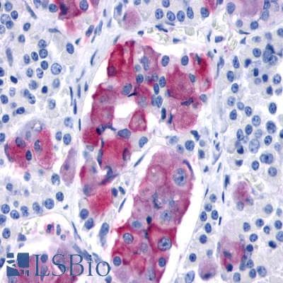 PathPlus™ PRLHR / GPR10 Antibody (Extracellular Domain)