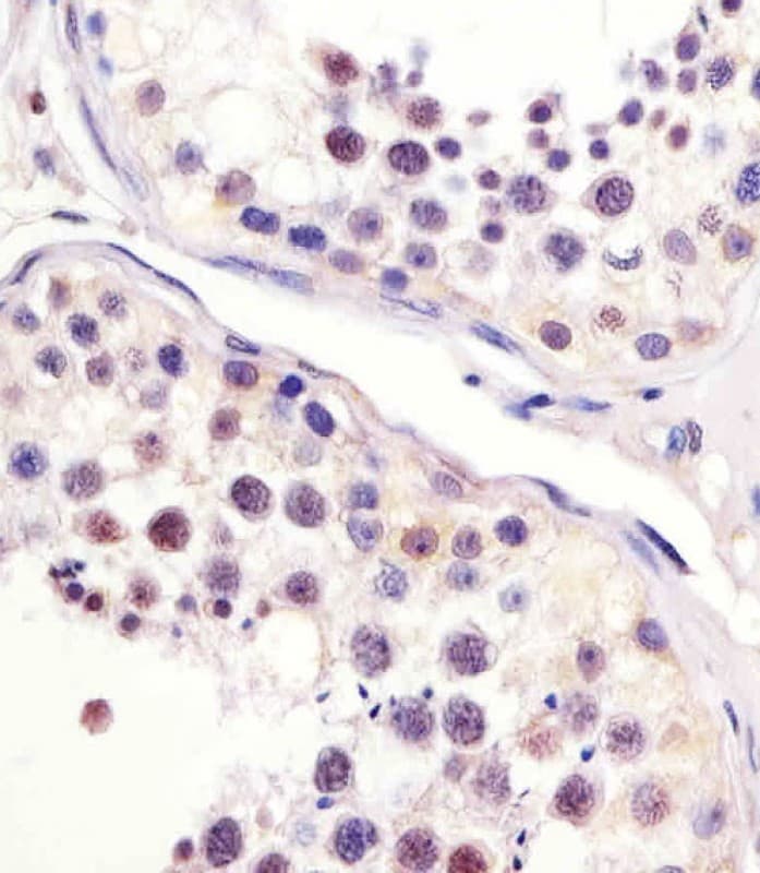 Monoclonal Mouse anti-Human CDC25C Antibody (clone 1535CT627.6.80, IHC, WB)