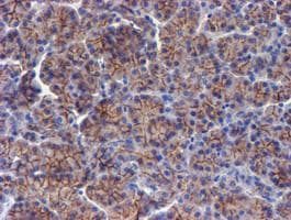 Monoclonal Mouse anti-Human ERBB2 / HER2 Antibody (clone OTI12G4, Carrier-free, aa676-1255, IHC, IF, WB)