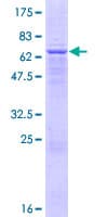 Human AACS Protein (Recombinant GST)