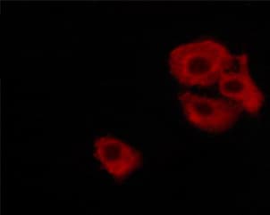 PPP1R1B / DARPP-32 Antibody (phospho-Thr34)