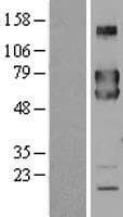 FKBP10 / FKBP65 Protein (Over-Expression Lysate Myc-DDK (Flag))