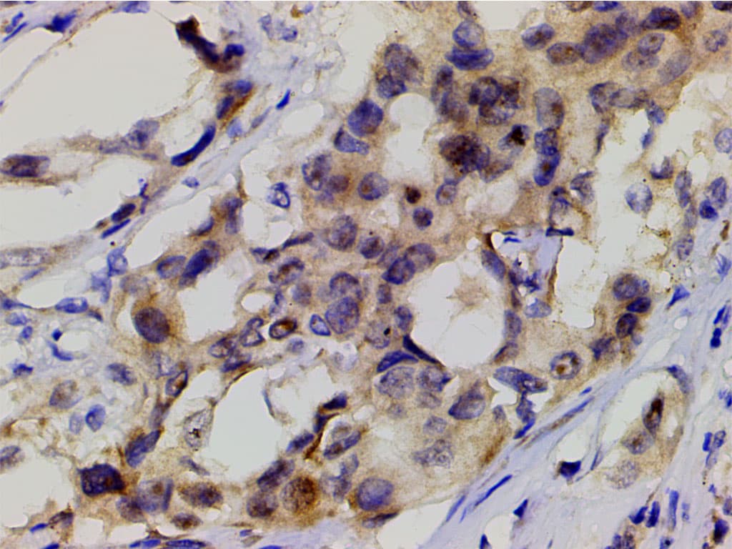 PIK3R1 / p85 Alpha Antibody (phospho-Tyr607)