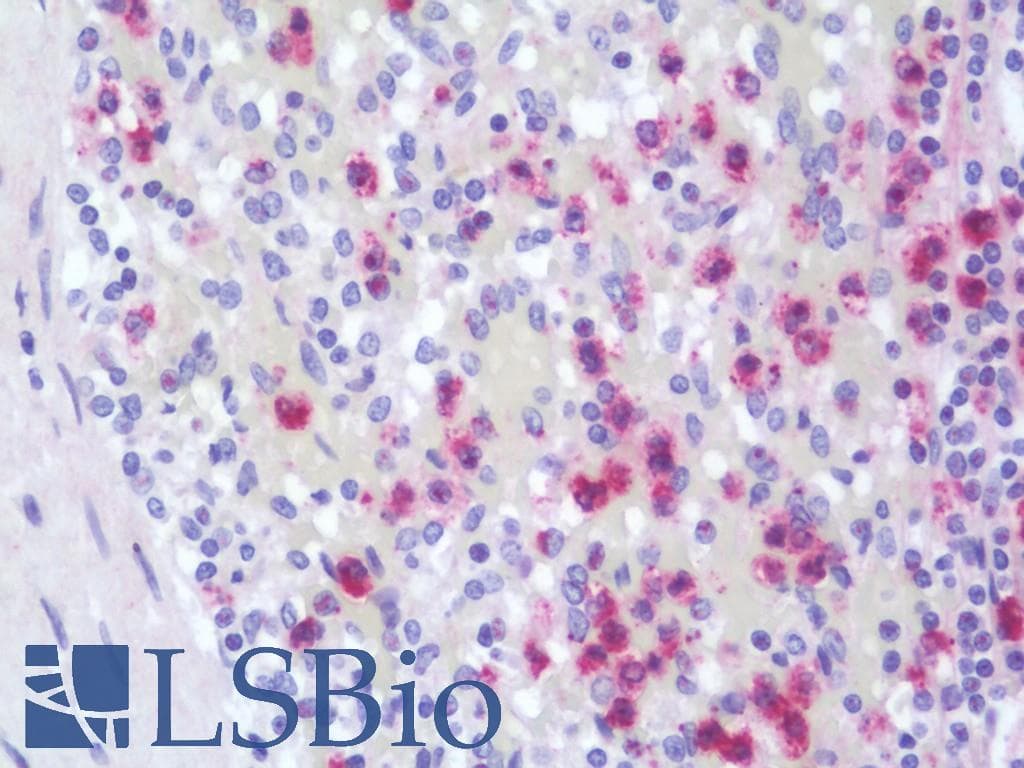 PathPlus™ CTSG / Cathepsin G Antibody (aa71-120)