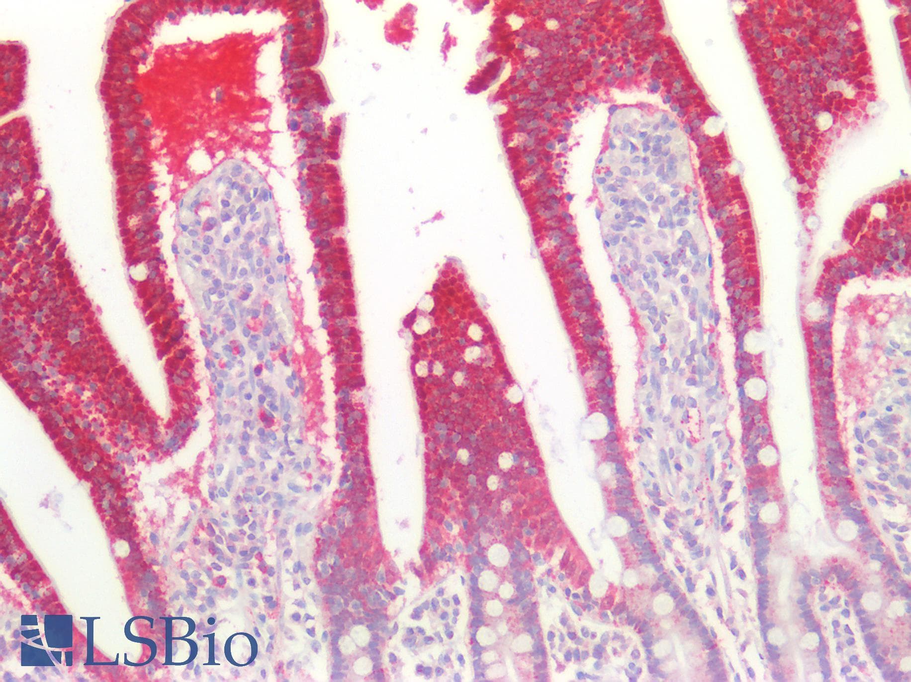 Polyclonal Rabbit anti-Human MPST Antibody (aa68-278, IHC, WB)