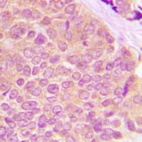 ETK / BMX Antibody (phospho-Tyr566)