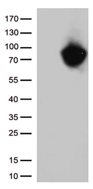 Monoclonal Mouse anti-Human MTHFR Antibody (clone OTI4C5, aa1-230, WB)