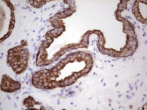Monoclonal Mouse anti-Human Acidic Cytokeratin AE1 Antibody (clone AE1, IHC)