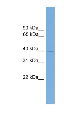 FOXB2 Antibody (aa341-390)