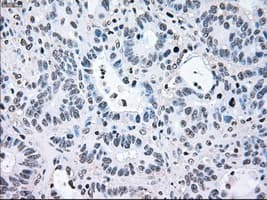 BRAF / B-Raf Antibody (clone OTI1G8)