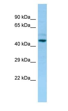 Polyclonal Rabbit anti-Human LILRA3 / CD85e Antibody (C-Terminus, WB)