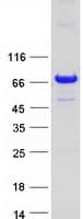 Human EPS8L1 Protein (Recombinant Myc-DDK (Flag))