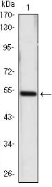 IHC-plus™ SHH / Sonic Hedgehog Antibody (clone 8G3)