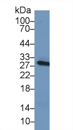 CRP / C-Reactive Protein Antibody (aa20-225)
