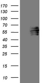 FOXC2 Antibody (aa1-280, clone OTI3E3)