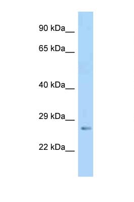 IGFBP5 Antibody (aa111-160)