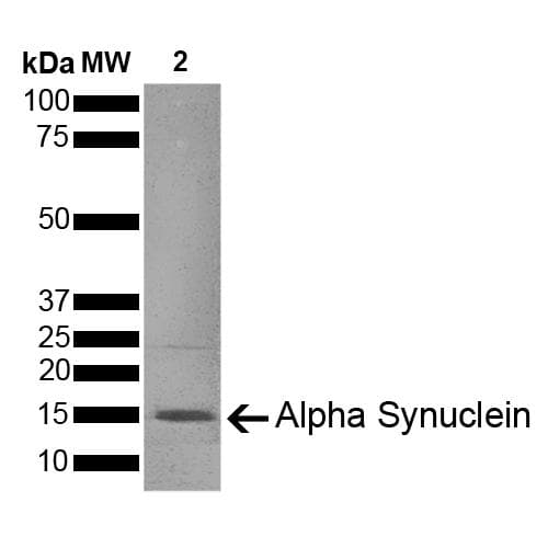 Mouse SNCA / Alpha-Synuclein Protein (Recombinant)