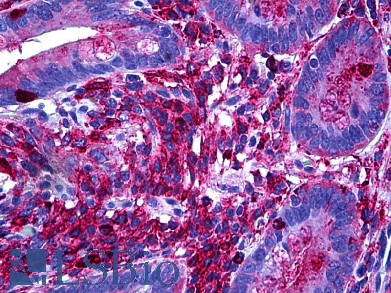 PathPlus™ Melanoma Antigen NKI/C3 Antibody (clone NKI/C3, Concentrated)