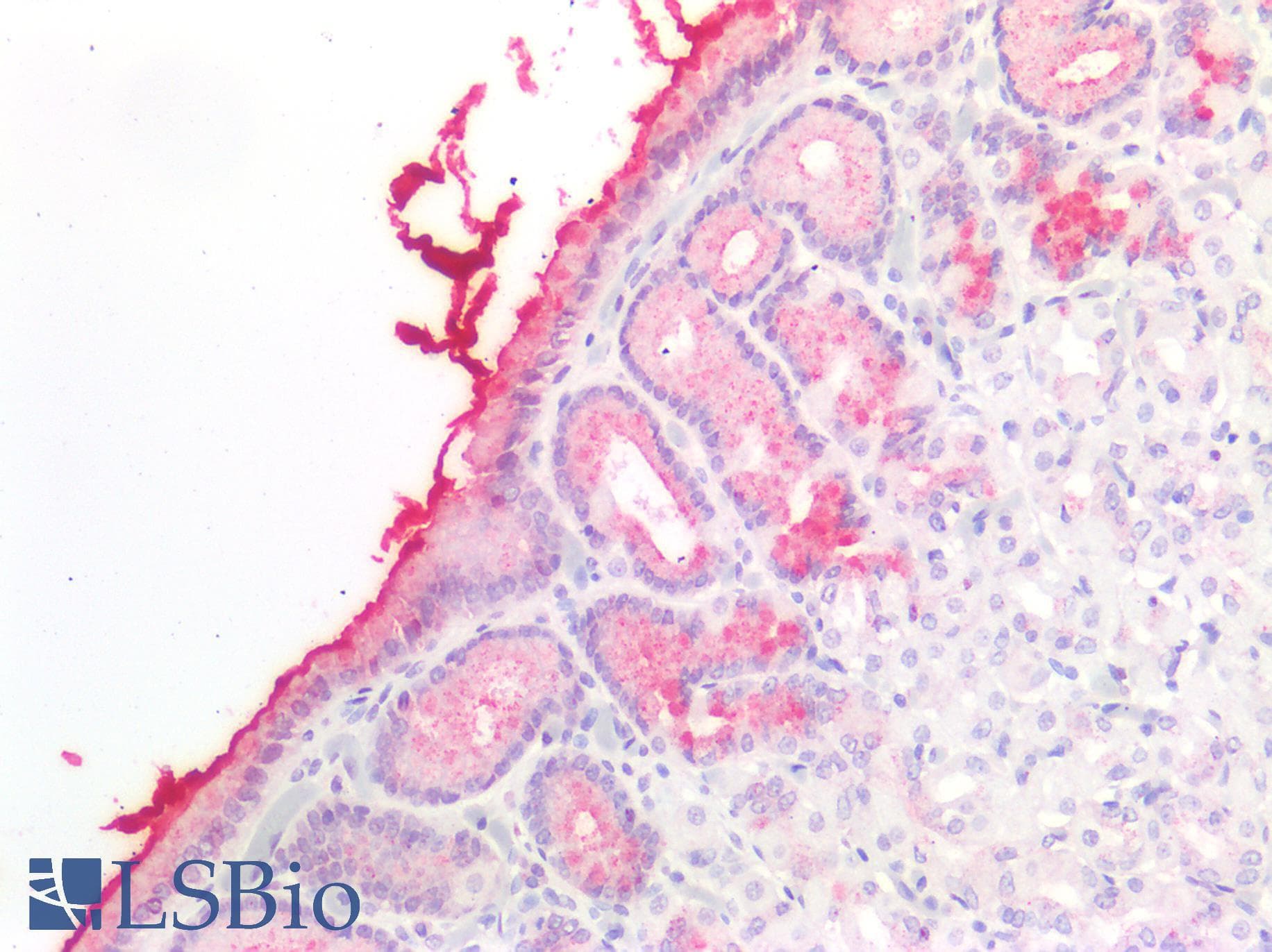 PathPlus™ MUC5AC Antibody