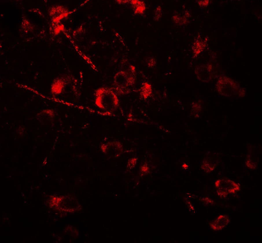 IHC-plus™ Polyclonal Rabbit anti-Human AMIGO Antibody (IHC, IF, WB)