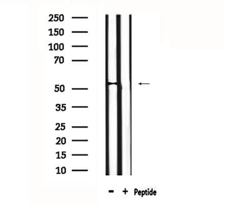 DUSP10 / MKP5 Antibody