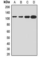 FASTKD1 Antibody