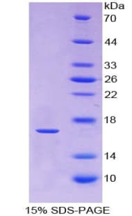 Human RXFP1/ LGR7 Protein (Recombinant His)