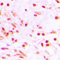 FRA-1 / FOSL1 Antibody (Internal)