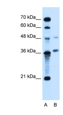 Polyclonal Rabbit anti-Human ARMCX6 Antibody (aa64-113, IHC, WB)