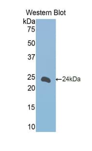 FCER2 / CD23 Antibody (aa150-330, APC, Cy7)