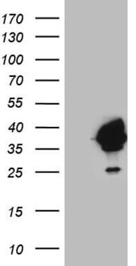DAPP1 / BAM32 Antibody (clone OTI1C10)