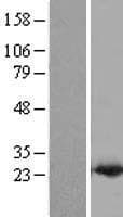 PDCD6 / ALG-2 Protein (Over-Expression Lysate Myc-DDK (Flag))