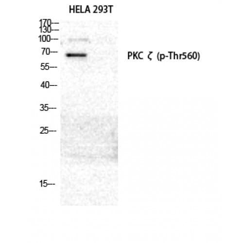 PRKCZ / PKC-Zeta Antibody (500-580 aa)
