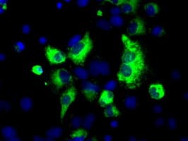 LOX / Lysyl Oxidase Antibody (aa22-168, clone OTI4E3, Carrier-free)
