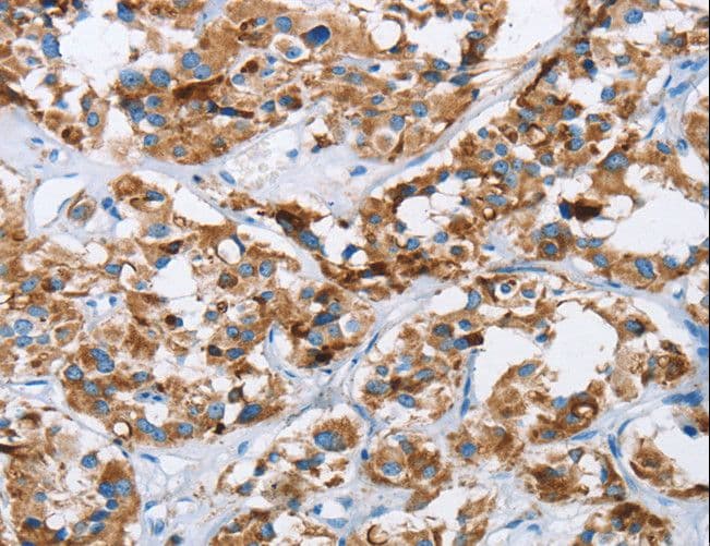 HINT2 Antibody