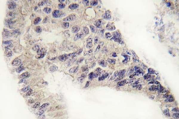 Recoverin Antibody (Asp143)