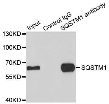 SQSTM1 Antibody