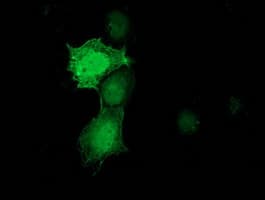 PNMT Antibody (clone OTI2D5)