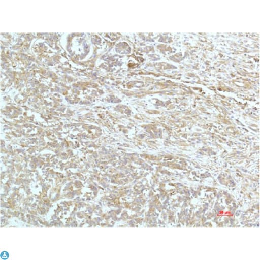 Alpha Actinin Antibody