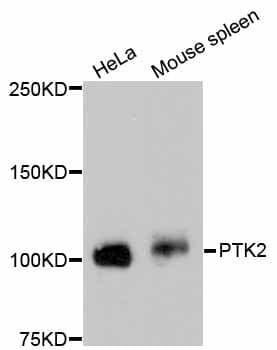 Monoclonal Rabbit anti-Human FAK / Focal Adhesion Kinase Antibody (IF, WB)