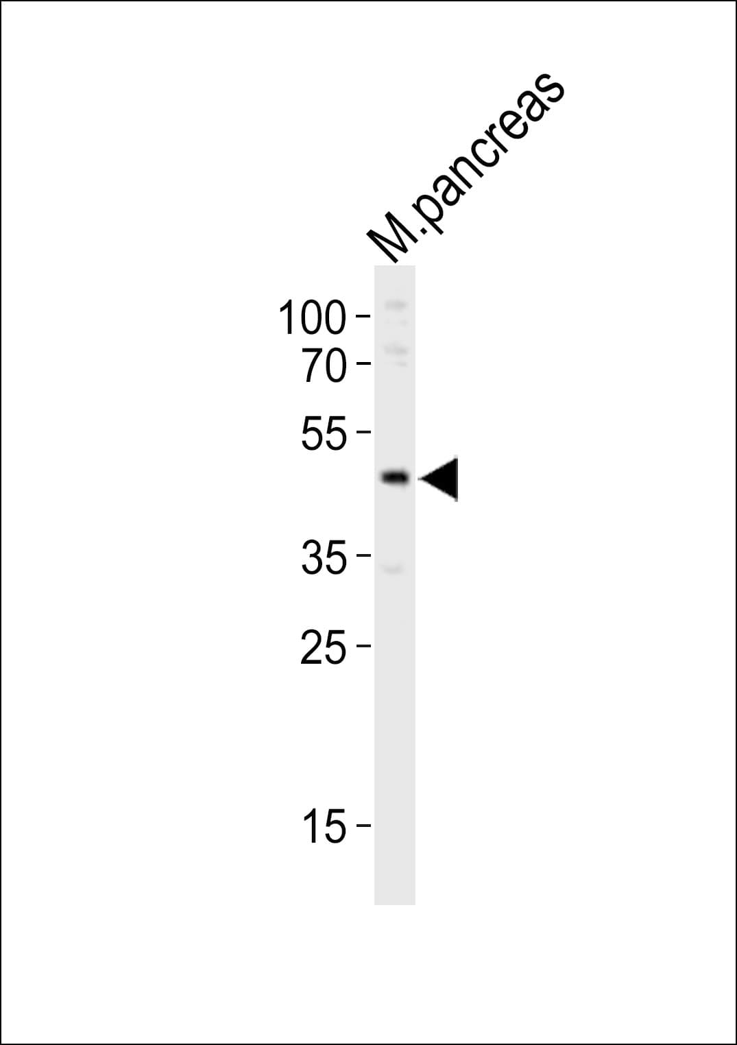 PDX1 Antibody (aa136-169)