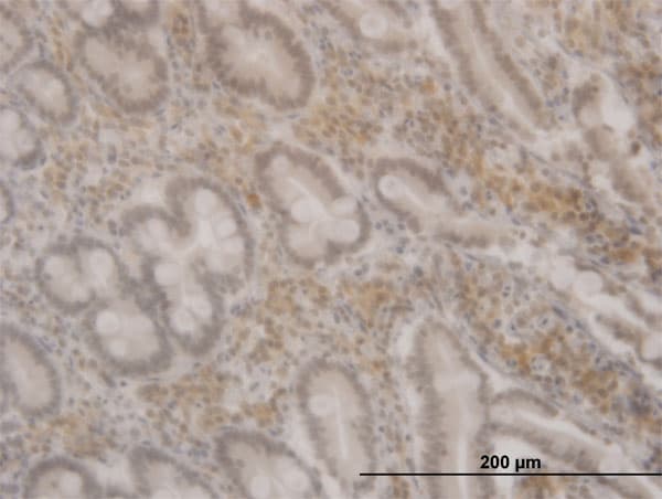 FOXO3 / FOXO3A Antibody (clone 1D2)