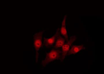 MSH3 Antibody