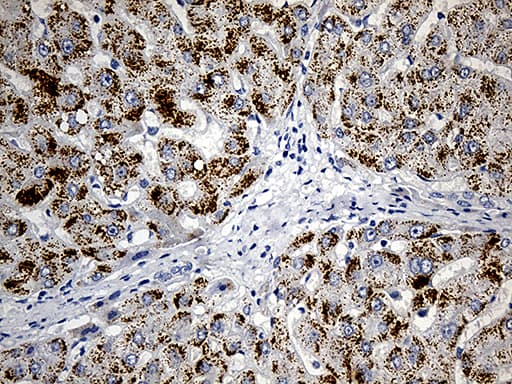 Monoclonal Mouse anti-Human ACAA1 Antibody (clone OTI4F1, IHC, WB)